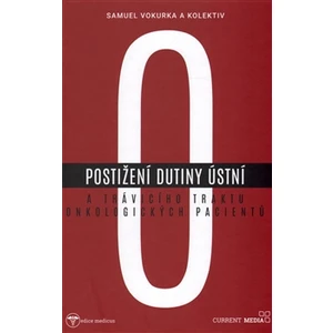Postižení dutiny ústní a trávicího traktu onkologických pacientů - Samuel Vokurka