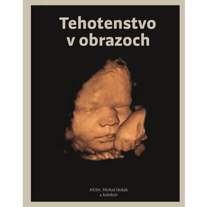 Tehotenstvo v obrazoch - Michal Holáň