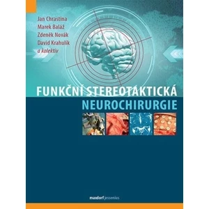 Funkční stereotaktická neurochirurgie - Zdeněk Novák, Jan Chrastina, Baláž Marek, Krahulík David