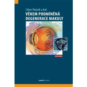 Věkem podmíněná degenerace makuly - Hejsek Libor