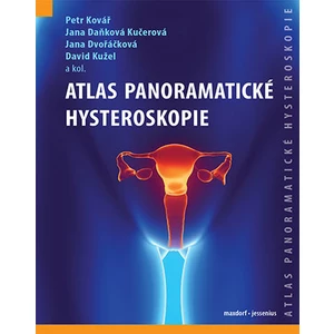 Atlas panoramatické hysteroskopie - Petr Kovář