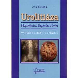 Urolitiáza. Etiopatogenéza, diagnostika a liečba - Ľupták Ján