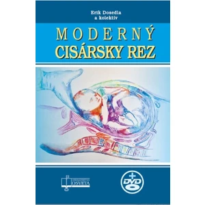 Moderný cisársky rez - Erik Dosedla