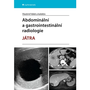 Abdominální a gastrointestinální radiologie, Válek Vlastimil