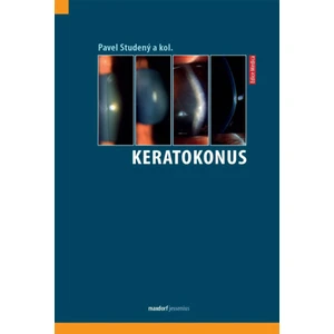 Keratokonus - Studený Pavel