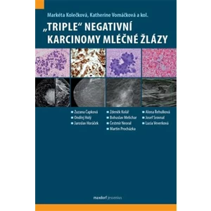 "Triple" negativní karcinomy mléčné žlázy - Markéta Kolečková