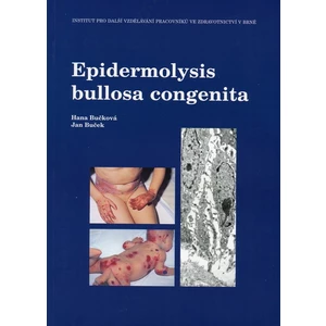 Epidermolysis bullosa congenita - Bučková Hana, Buček Jan
