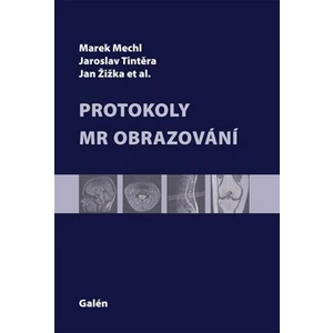 Protokoly MR Zobrazování - Marek Mechl, Jaroslav Tintěra, Jan Žižka