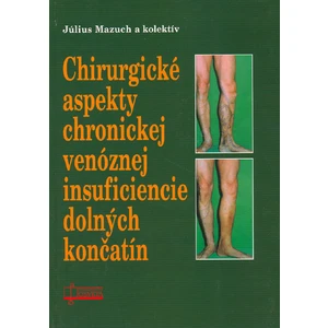 Chirurgické aspekty chronickej venóznej insuficiencie dolných končatín
