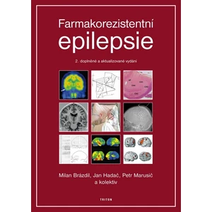 Farmakorezistentni epilepsie