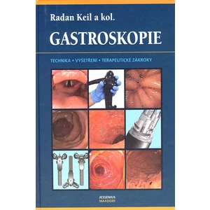 Gastroskopie
