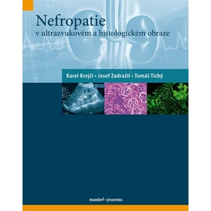 Nefropatie - Krejčí Karel, Zadražil Josef, Tichý Tomáš