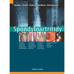 Spondyloartritidy - Karel Pavelka, kolektiv autorů, Jarmila Heissigerová, Markéta Hušáková, Ladislav Šenolt, Liliana Šedová