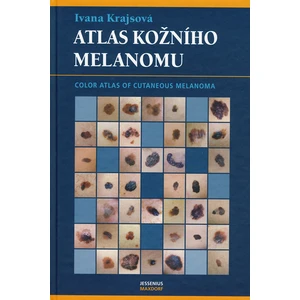 Atlas kožního melanomu - Krajsová Ivana