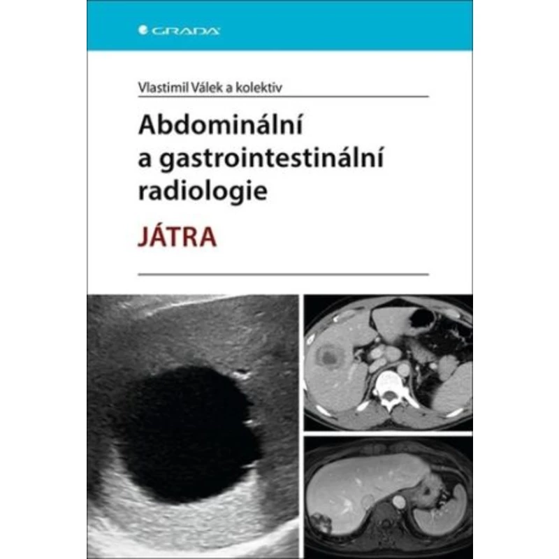 Abdominální a gastrointestinální radiologie - Vlastimil Válek